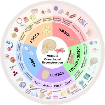 Mesenchymal stem cells in craniofacial reconstruction: a comprehensive review